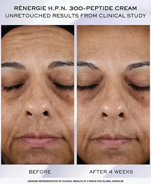Lancôme Rénergie 3-Step Skin Care Set